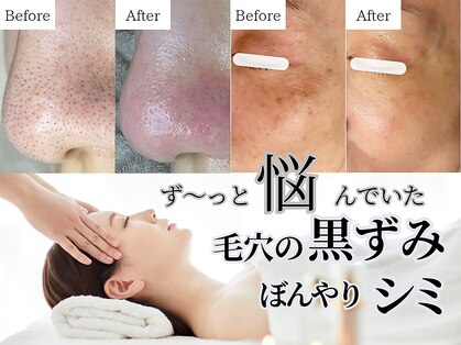 ティーツリー 名古屋 桜山(Tea Tree)の写真