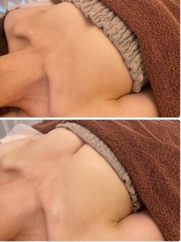 エスビューティー 三軒茶屋(S beauty)/バストケア・駒澤大学・痩身