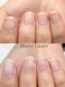 マリーロール 梅田店(Marie Laure)/深爪矯正/自爪育成/自爪風