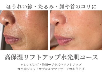エクラ イオンモール徳島店(ECLAT)/高保湿リフトアップ水光肌コース