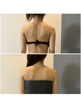 モア(moa)/韓国アイドルのような直角肩☆