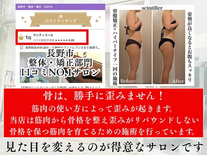 サンティエールの写真
