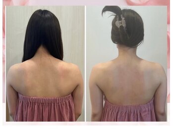 ロココ 豊田店(Rococo)/ビフォーアフター