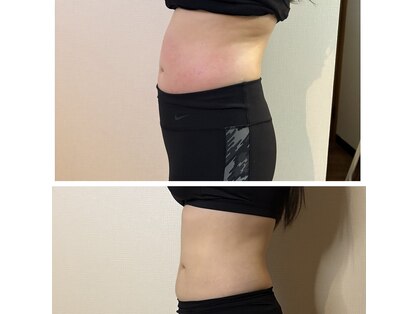 ボディケア パワーナ(Body care pawa-na)の写真