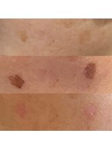 アンドミー(and me)/鹿児島/唐湊/トータルケア