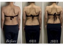 プラスベル(plus Belle)の雰囲気(ダイエット痩身と体質改善.自律神経.睡眠質向上◎ 最新BODY管理)
