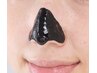 【イチゴ鼻の方おススメ】鼻周りの毛穴ケア30分￥3,500→￥2,480