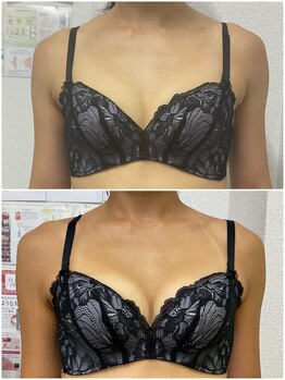 バーディー(BIRDIE)/施術3回/４０代ママ