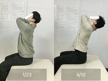 ナオル整体 国分寺院(NAORU整体)/30代男性【背中の疲れ】