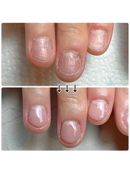 長さ出し無しでも見た目は変わる