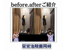 栄光治院 整体院東岡崎/学生猫背増えてます、、！！