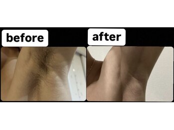 ゴッド(GOD)/ビフォーアフター