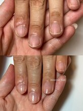 マイントゥ ネイル(mine too nail)/育成ネイルの可能性★！！