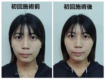 トータルバランス整体院 &nbsp;オレンジ(ORANGE)/小顔矯正/むくみ/ほお骨出っ張り