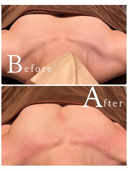 ロココ 水戸店(Rococo)/バストアップBefore After