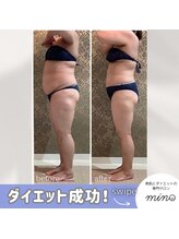 ミノ 美里大通り店(mino)/ダイエットパッケージプラン
