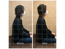 トラスト整体院 小池院/３0代/男性/工場勤務/頭痛