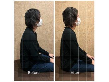 トラスト整体院 小池院/３0代/男性/工場勤務/頭痛