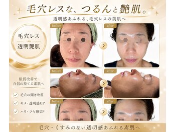 スカイ(sky)の写真/毛穴レスな素肌へ。もうファンデで隠さない。