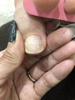 アウラ 新宿西口店(aura)/ネイリスト吉野★巻き爪