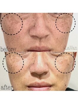 ラヴァン(LaVan)/塗る金の糸(5回)