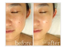 アン グレーヌ 自由が丘(unegraine)/輪郭すっきり持ち上がる！