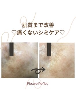 フルーヴ ルフレ(Fleuve Reflet)/ー5歳肌☆エイジング予防にも☆