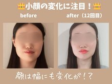 安らぎ夢サロン/小顔施術