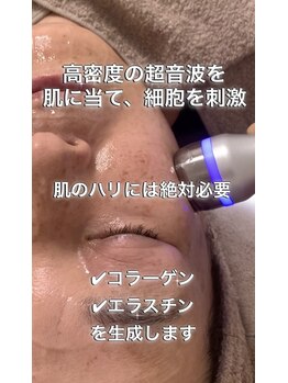 ニコ(25)/痛みの少ないリフトアップ