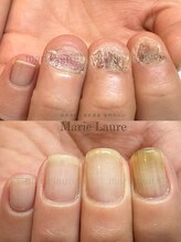 マリーロール 淀屋橋本店(Marie Laure)/深爪矯正/自爪育成/ネイルケア