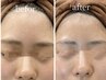 オススメ[剥離なし]白玉ピーリング　くすみ透明感特化！高濃度美容液