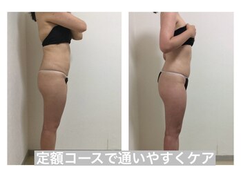 マッチ(much)/好きな回数を選べる定額ケアあり