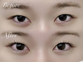 リル 名古屋駅前店(Rill)/before・after