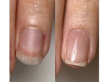 ロイヤル ネイルサロン(Royal nail Saloon)/自爪育成
