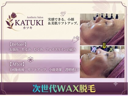 エステサロン カツキ(KATUKI)の写真