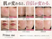 プライムミー 北千住店(Prime Me)