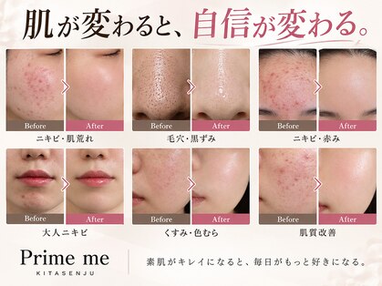 プライムミー 北千住店(Prime Me)の写真