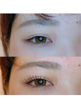 アディクト 恵比寿店(ADDICT)/重ためなまぶたもぱっちり