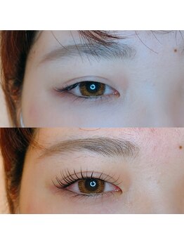 アディクト 恵比寿店(ADDICT)/重ためなまぶたもぱっちり