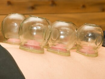 上毛鍼灸院/吸角【カッピング】