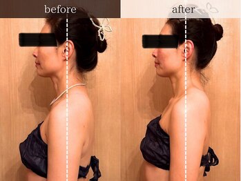 ティアラ/before after　