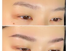 ヴィータ(VITA)/ハリウッドブロウリフト