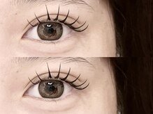 エム アイデザイン(M.eyedesign)/&healthy＋フラット140本