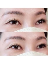 アール(R.)/LED カラーエクステ 140本