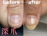 【深爪育成】ジェル仕上げ＋育成オイル付き◎指先より爪が短い方はコチラ！