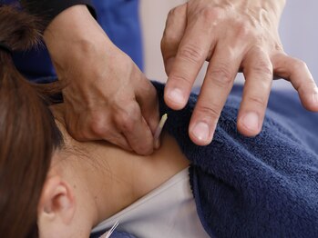 輝整骨院かがやき鍼灸院 古河店/鍼灸施術