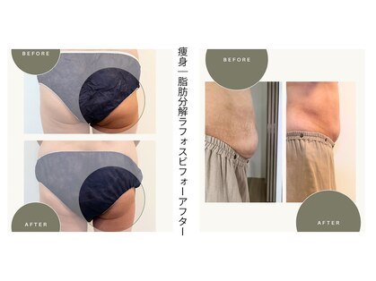 ビオン 松戸(bion)の写真