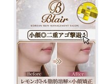 ブレア(Blair)