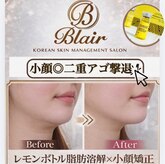 ブレア(Blair)