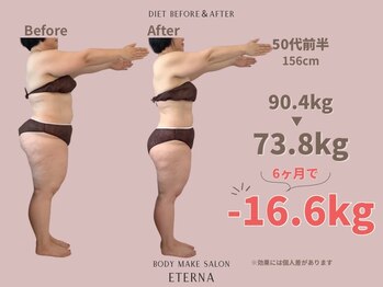 エテルナ(Eterna)/安城市　ダイエット　痩身